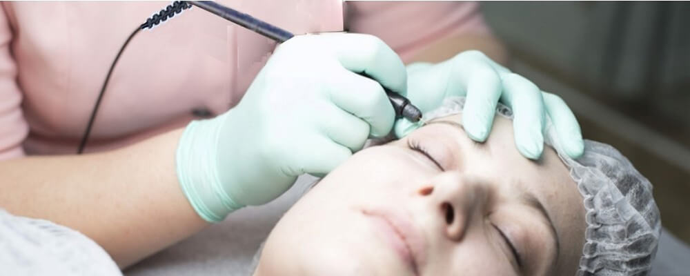 Electrolysis Treatments at Caddell's Laser Clinic