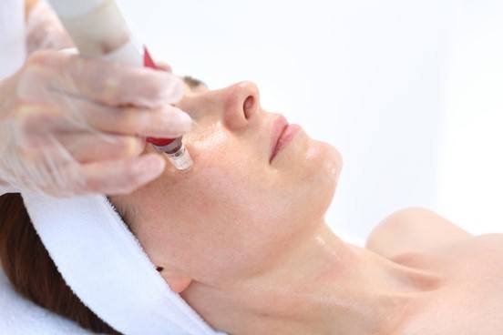 Microneedling For Wrinkles & Stretch Marks